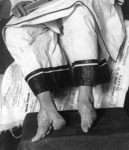 A woman&rsquo;s feet without the bindings (c. 1900; courtesy of the Library of Congress, LC-USZ62-71351).